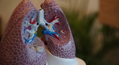 Study finds why people with lung disease are more susceptible to Covid | Study finds why people with lung disease are more susceptible to Covid