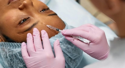 1 in 6 US parents support teenagers getting laser hair removal, chemical skin peels: Study | 1 in 6 US parents support teenagers getting laser hair removal, chemical skin peels: Study 1 in 6 US parents support teenagers getting laser hair removal, chemical skin peels: Study | 1 in 6 US parents support teenagers getting laser hair removal, chemical skin peels: Study