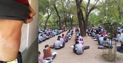 Gujarat: Pupil gets corporal punishment, school assures action after report | Gujarat: Pupil gets corporal punishment, school assures action after report