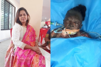 Man torches Dalit partner to death in Bengaluru | Man torches Dalit partner to death in Bengaluru Man torches Dalit partner to death in Bengaluru | Man torches Dalit partner to death in Bengaluru
