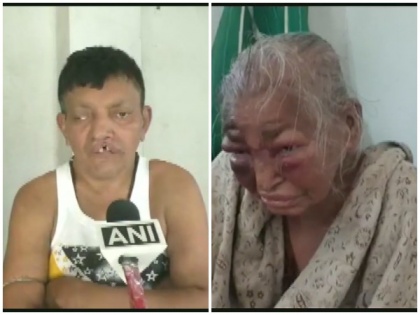 BJP worker alleges TMC workers of brutally attacking him, mother in Bengal's North Dumdum | BJP worker alleges TMC workers of brutally attacking him, mother in Bengal's North Dumdum
