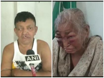 West Bengal: BJP worker's mother, who was allegedly attacked by TMC workers in February, dies | West Bengal: BJP worker's mother, who was allegedly attacked by TMC workers in February, dies