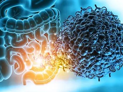 Study shows our gut microbes may determine bone health | Study shows our gut microbes may determine bone health Study shows our gut microbes may determine bone health | Study shows our gut microbes may determine bone health