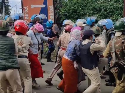 'Pellet injuries' in strife-torn Manipur serve stark reminder to J&K unrest | 'Pellet injuries' in strife-torn Manipur serve stark reminder to J&K unrest 'Pellet injuries' in strife-torn Manipur serve stark reminder to J&K unrest | 'Pellet injuries' in strife-torn Manipur serve stark reminder to J&K unrest