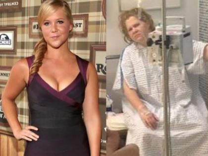 Amy Schumer posts image of herself hooked to an IV drip to warn women in 20s | Amy Schumer posts image of herself hooked to an IV drip to warn women in 20s Amy Schumer posts image of herself hooked to an IV drip to warn women in 20s | Amy Schumer posts image of herself hooked to an IV drip to warn women in 20s