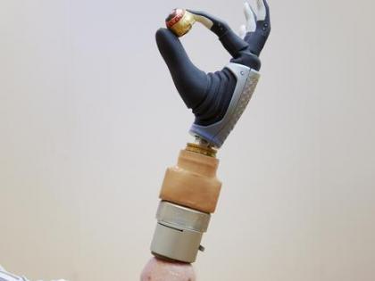 Bionic hand, merged with woman's nervous & skeletal systems, functional after years | Bionic hand, merged with woman's nervous & skeletal systems, functional after years Bionic hand, merged with woman's nervous & skeletal systems, functional after years | Bionic hand, merged with woman's nervous & skeletal systems, functional after years