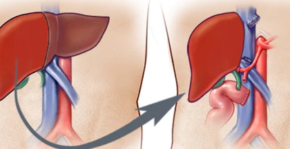 On Dassehra, deceased Mumbai man’s organs give new life to three patients | On Dassehra, deceased Mumbai man’s organs give new life to three patients On Dassehra, deceased Mumbai man’s organs give new life to three patients | On Dassehra, deceased Mumbai man’s organs give new life to three patients