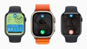 Apple Watch ban may cost firm $300 to $400 mn in sales: Report | Apple Watch ban may cost firm $300 to $400 mn in sales: Report Apple Watch ban may cost firm $300 to $400 mn in sales: Report | Apple Watch ban may cost firm $300 to $400 mn in sales: Report