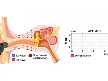 Google scientists use noise-canceling headphones to measure heart rate | Google scientists use noise-canceling headphones to measure heart rate