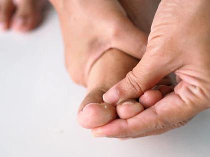 How diabetes can affect health of your skin and feet | How diabetes can affect health of your skin and feet