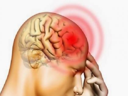New MRI study reveals how brain changes in long-Covid patients | New MRI study reveals how brain changes in long-Covid patients New MRI study reveals how brain changes in long-Covid patients | New MRI study reveals how brain changes in long-Covid patients