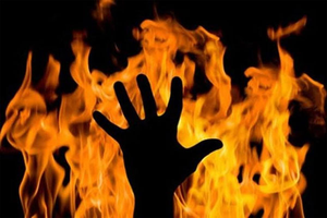 UP: 3 kids burnt alive as fire erupts in hut, parents critical | UP: 3 kids burnt alive as fire erupts in hut, parents critical