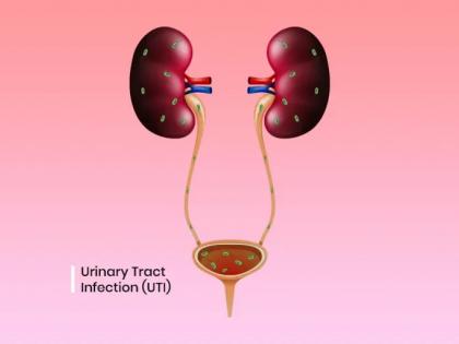 'Indian women less aware about urinary tract infection' | 'Indian women less aware about urinary tract infection'
