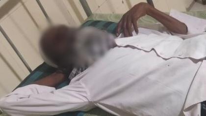 Visually-challenged man assaulted, forced to chant 'Jai Sriram' in K'taka | Visually-challenged man assaulted, forced to chant 'Jai Sriram' in K'taka Visually-challenged man assaulted, forced to chant 'Jai Sriram' in K'taka | Visually-challenged man assaulted, forced to chant 'Jai Sriram' in K'taka