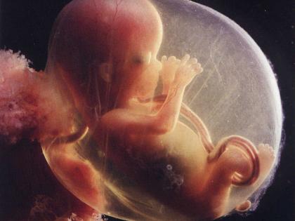 K’taka foeticide scam: Foetuses thrown in dustbin & left to decompose with medical waste, says accused nurse | K’taka foeticide scam: Foetuses thrown in dustbin & left to decompose with medical waste, says accused nurse K’taka foeticide scam: Foetuses thrown in dustbin & left to decompose with medical waste, says accused nurse | K’taka foeticide scam: Foetuses thrown in dustbin & left to decompose with medical waste, says accused nurse