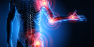 Increased understanding of arthritis helps overcome complications, say doctors | Increased understanding of arthritis helps overcome complications, say doctors Increased understanding of arthritis helps overcome complications, say doctors | Increased understanding of arthritis helps overcome complications, say doctors