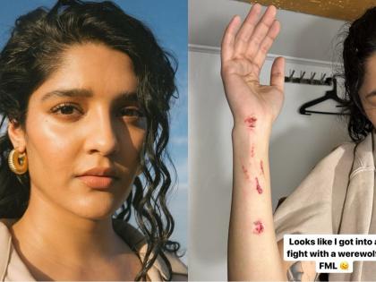 'Thalaivar 170' actress Ritika Singh injured during shoot | 'Thalaivar 170' actress Ritika Singh injured during shoot 'Thalaivar 170' actress Ritika Singh injured during shoot | 'Thalaivar 170' actress Ritika Singh injured during shoot