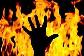Bengaluru youth immolates himself after lover ends relationship | Bengaluru youth immolates himself after lover ends relationship