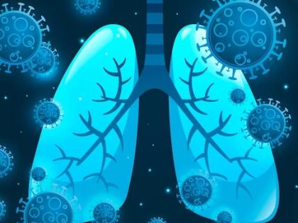 Covid virus can persist in lungs for up to 2 years: Study | Covid virus can persist in lungs for up to 2 years: Study