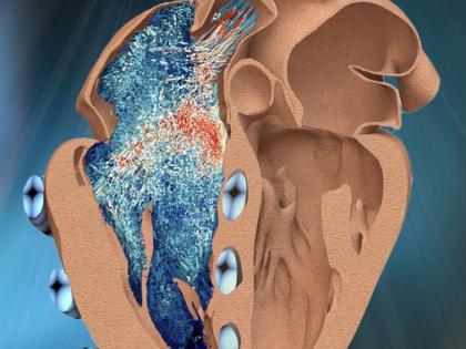 Indian-origin MIT engineer designs robotic replica of heart’s right chamber | Indian-origin MIT engineer designs robotic replica of heart’s right chamber Indian-origin MIT engineer designs robotic replica of heart’s right chamber | Indian-origin MIT engineer designs robotic replica of heart’s right chamber