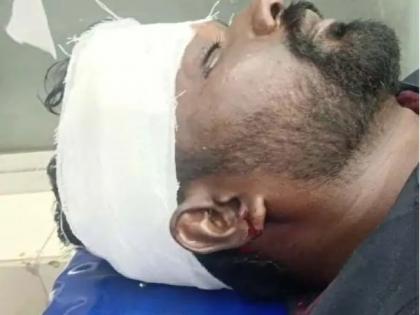K’taka: BJP worker attacked for questioning Cong MLA on social media | K’taka: BJP worker attacked for questioning Cong MLA on social media K’taka: BJP worker attacked for questioning Cong MLA on social media | K’taka: BJP worker attacked for questioning Cong MLA on social media