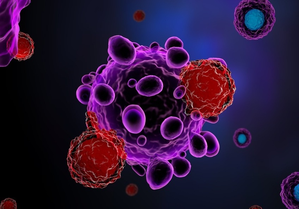 Study shows cell therapy is safe & effective for tumour in remission | Study shows cell therapy is safe & effective for tumour in remission Study shows cell therapy is safe & effective for tumour in remission | Study shows cell therapy is safe & effective for tumour in remission