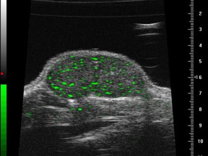 Microbubbles boosting ultrasound imaging, personalised medicine: Report | Microbubbles boosting ultrasound imaging, personalised medicine: Report Microbubbles boosting ultrasound imaging, personalised medicine: Report | Microbubbles boosting ultrasound imaging, personalised medicine: Report