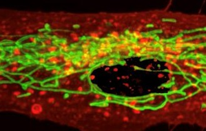 Study finds blood biomarkers linked to suicidal thoughts | Study finds blood biomarkers linked to suicidal thoughts