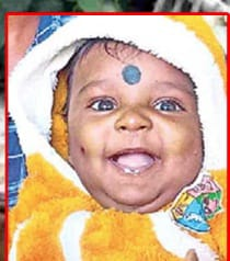 Five-month-old baby dies in attack by stray dogs in Hyderabad | Five-month-old baby dies in attack by stray dogs in Hyderabad Five-month-old baby dies in attack by stray dogs in Hyderabad | Five-month-old baby dies in attack by stray dogs in Hyderabad
