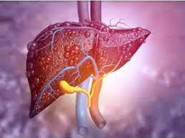 Mice study unravels new insights to boost treatment of liver fibrosis | Mice study unravels new insights to boost treatment of liver fibrosis
