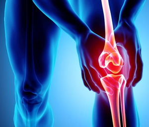 Early detection of 'osteoarthritis' may allow therapy that improves joint health: Researchers | Early detection of 'osteoarthritis' may allow therapy that improves joint health: Researchers