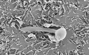 New insights into fungal infections can lead to better treatments | New insights into fungal infections can lead to better treatments