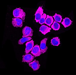 Study finds new immune cell to attack and eliminate cancer, Covid | Study finds new immune cell to attack and eliminate cancer, Covid