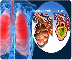 New cell therapy shows promise for Covid-related respiratory distress | New cell therapy shows promise for Covid-related respiratory distress New cell therapy shows promise for Covid-related respiratory distress | New cell therapy shows promise for Covid-related respiratory distress