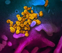 Study finds genetic factors for severe Lassa fever | Study finds genetic factors for severe Lassa fever Study finds genetic factors for severe Lassa fever | Study finds genetic factors for severe Lassa fever