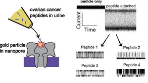 New method may detect early ovarian cancer from urine test | New method may detect early ovarian cancer from urine test New method may detect early ovarian cancer from urine test | New method may detect early ovarian cancer from urine test