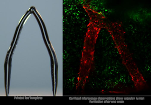 3D ice printing can create artificial blood vessels in engineered tissue | 3D ice printing can create artificial blood vessels in engineered tissue 3D ice printing can create artificial blood vessels in engineered tissue | 3D ice printing can create artificial blood vessels in engineered tissue