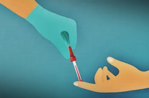 New blood test offers hope for early detection of Parkinson's disease | New blood test offers hope for early detection of Parkinson's disease New blood test offers hope for early detection of Parkinson's disease | New blood test offers hope for early detection of Parkinson's disease