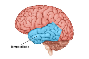 Mumbai woman cured of epilepsy after part of her brain removed | Mumbai woman cured of epilepsy after part of her brain removed