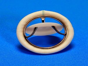 Upgraded Chitra heart valve implanted in 40 patients in pilot project; results promising | Upgraded Chitra heart valve implanted in 40 patients in pilot project; results promising