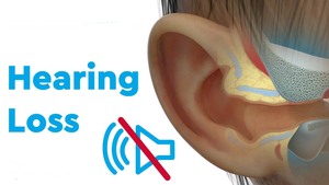 Why early identification & intervention for hearing loss is necessary | Why early identification & intervention for hearing loss is necessary Why early identification & intervention for hearing loss is necessary | Why early identification & intervention for hearing loss is necessary