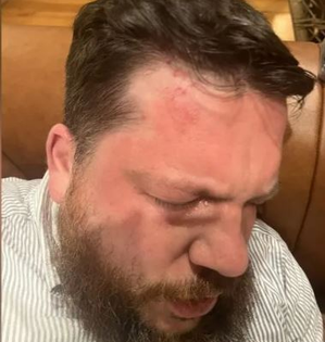 Putin critic Navalny's ally Leonid Volkov attacked in Lithuania | Putin critic Navalny's ally Leonid Volkov attacked in Lithuania