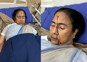SSKM Director Says Mamata Banerjee Probably Fell Due To ‘Push’ From Behind | SSKM Director Says Mamata Banerjee Probably Fell Due To ‘Push’ From Behind