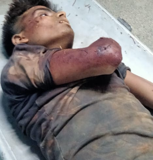 BSF Firing at Tripura Border: Bangladeshi Smuggler Killed, Another Injured, 3 Rohingya Arrested | BSF Firing at Tripura Border: Bangladeshi Smuggler Killed, Another Injured, 3 Rohingya Arrested