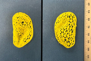 Scientists create replica of an adult human ear that looks & feels natural | Scientists create replica of an adult human ear that looks & feels natural Scientists create replica of an adult human ear that looks & feels natural | Scientists create replica of an adult human ear that looks & feels natural