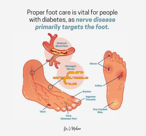 Here's how to take care of your foot health if you have diabetes | Here's how to take care of your foot health if you have diabetes