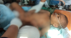 After 17 hours long efforts, toddler Satwik Mujagonda rescued from borewell | After 17 hours long efforts, toddler Satwik Mujagonda rescued from borewell After 17 hours long efforts, toddler Satwik Mujagonda rescued from borewell | After 17 hours long efforts, toddler Satwik Mujagonda rescued from borewell