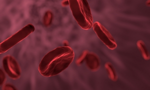 Gene therapy holds promise for blood disorder haemophilia: Doctors | Gene therapy holds promise for blood disorder haemophilia: Doctors Gene therapy holds promise for blood disorder haemophilia: Doctors | Gene therapy holds promise for blood disorder haemophilia: Doctors