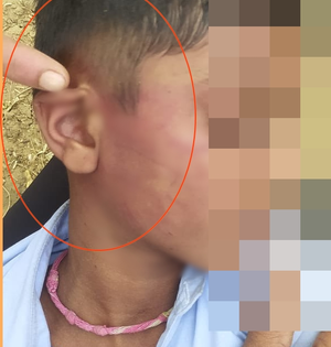 Class 3 student beaten mercilessly in Rajasthan school, teacher suspended | Class 3 student beaten mercilessly in Rajasthan school, teacher suspended Class 3 student beaten mercilessly in Rajasthan school, teacher suspended | Class 3 student beaten mercilessly in Rajasthan school, teacher suspended