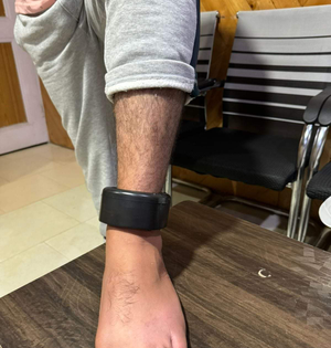 J&K Police starts using GPS tracker anklets to monitor criminals on bail | J&K Police starts using GPS tracker anklets to monitor criminals on bail J&K Police starts using GPS tracker anklets to monitor criminals on bail | J&K Police starts using GPS tracker anklets to monitor criminals on bail